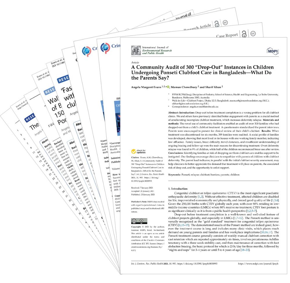 Published clubfoot research papers