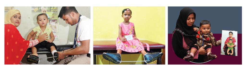 Children wearing WFL braces at clinic follow-up visits